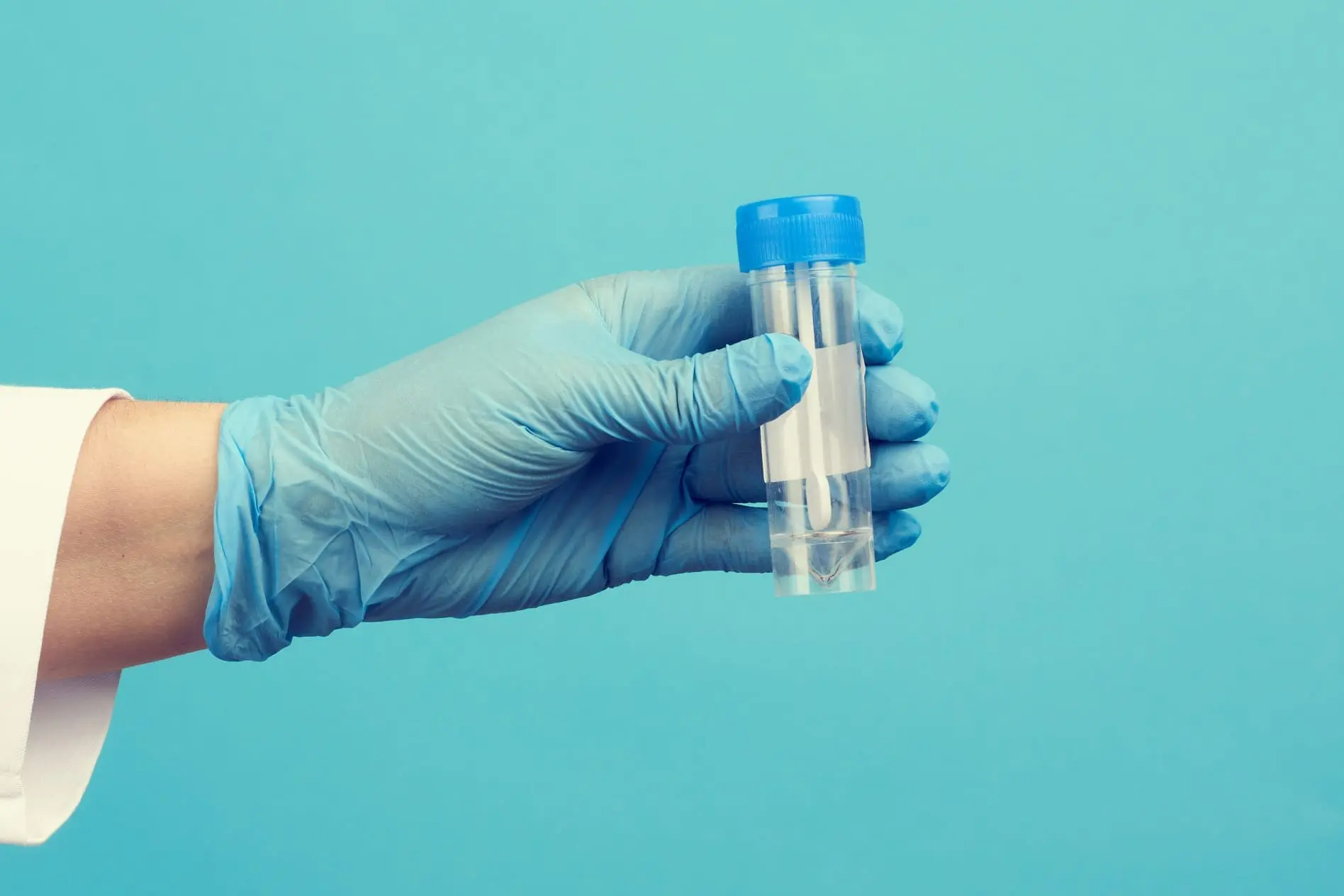 Médico de jaleco branco e luvas azuis de látex estéreis segura um frasco de plástico para exame de fezes.